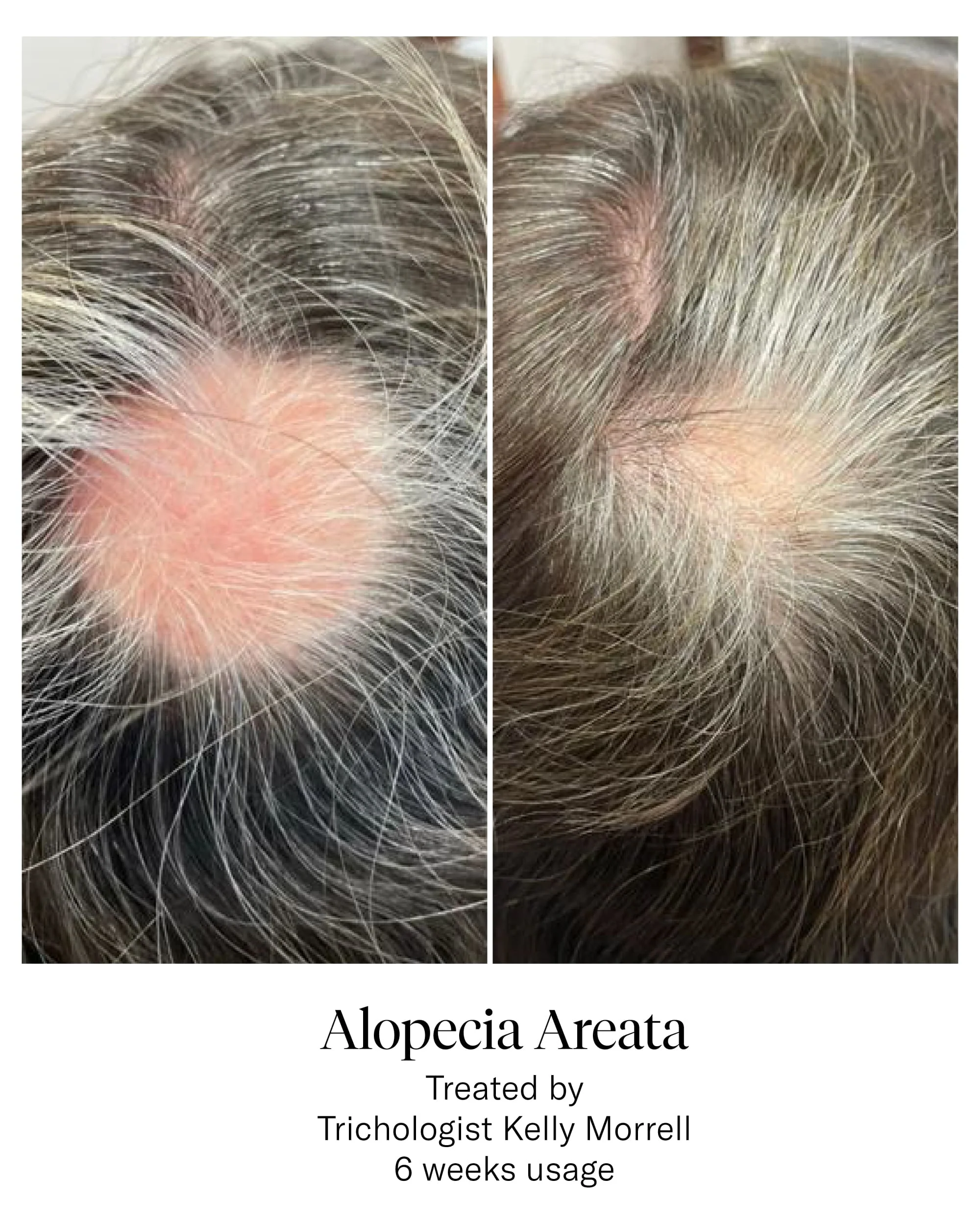 Hair Serum - Image 8